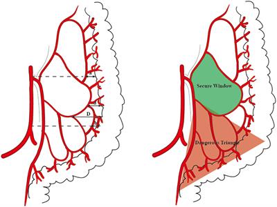 The value of ICG-guided left colon vascular variation and anatomical rules for the radical resection of proctosigmoid colon cancer